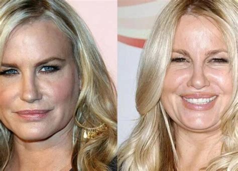 jennifer coolidge before surgery|Plastic Surgery • Dermatology 